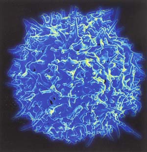 健康な人の免疫システムのＴリンパ球（Ｔ細胞）の電子顕微鏡写真出典：国立アレルギー感染病研究所