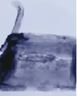 内部のレントゲン写真から、２匹の子供のコブラのミイラが納められていることが判明した。